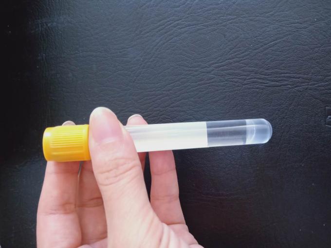 Blood Collection Tube AdditivesSerum Separation Gel Customized gravity